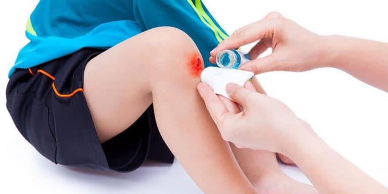 5 Cara Merawat Luka Anak Yang Ibu Bapa Perlu Tahu