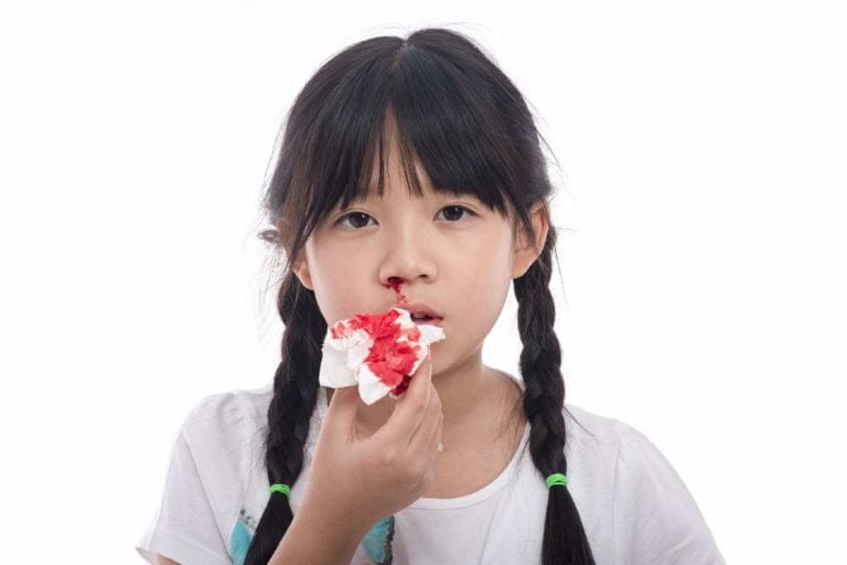 Ketahui 6 Punca Hidung Berdarah Pada Kanak-Kanak