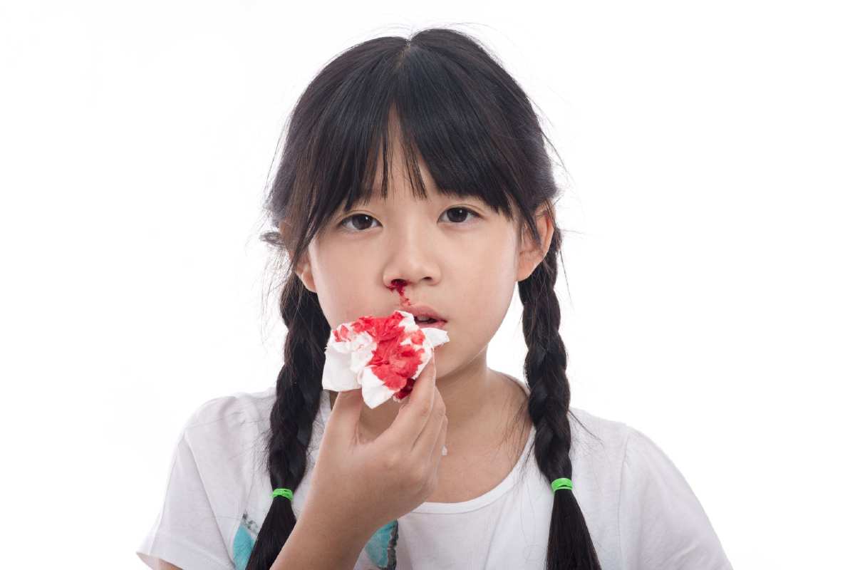 Ketahui 6 Punca Hidung Berdarah Pada Kanak-Kanak