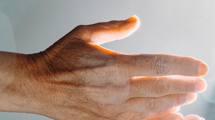 13 Punca Kulit Kering & Bersisik